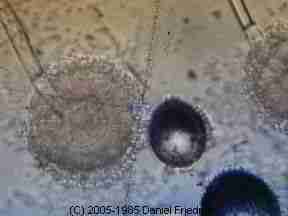 //reforcerestoration.com/wp-content/uploads/2024/01/ReForce-Restoration-aspergillus-microscope-view.jpg